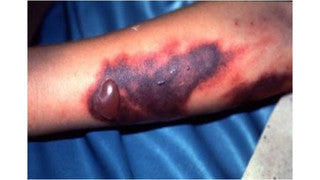 EMS/Nursing/Trauma Moulage Kit