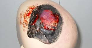 EMS/Nursing/Trauma Moulage Kit